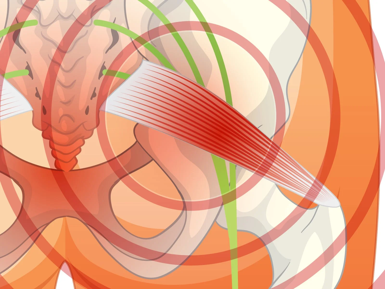 Sindrome del Piriforme: la Chiropratica può aiutarmi?