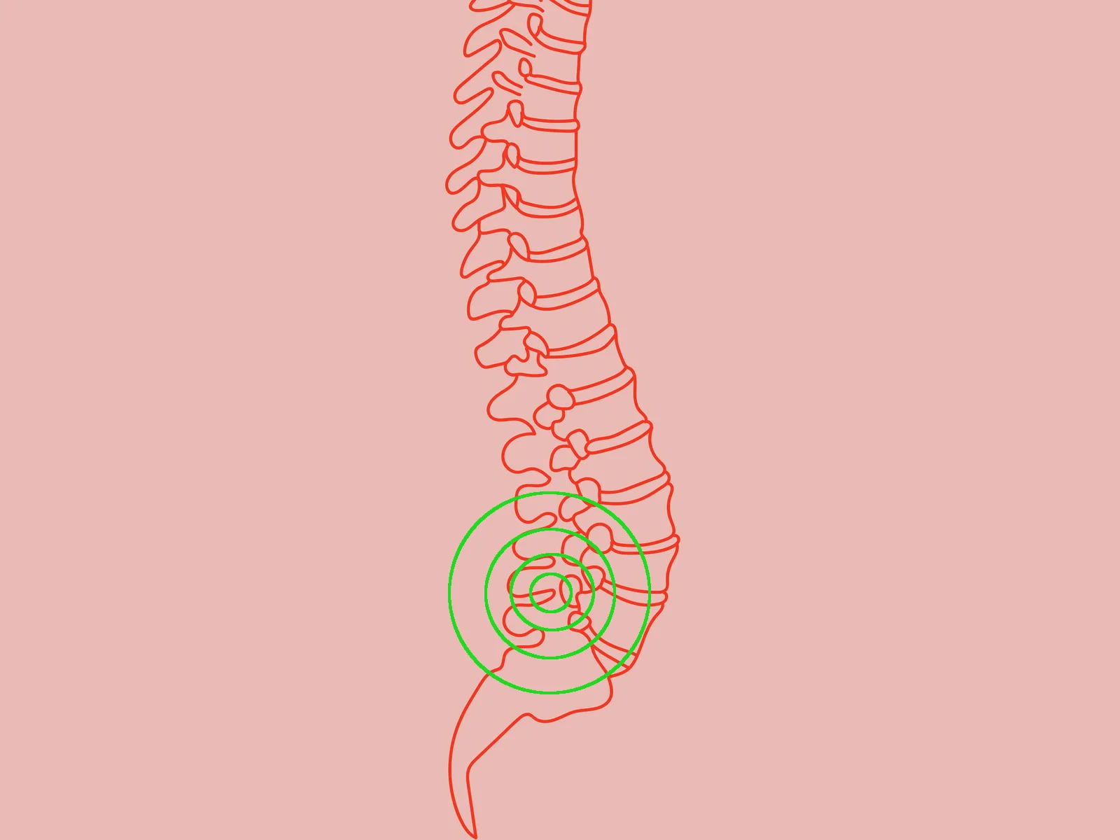 La Chiropratica per la Sindrome delle Faccette Articolari